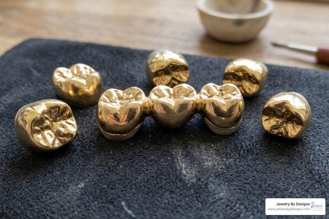 The Tooth Hurts: Finding the Best Dental Scrap Gold Buyers